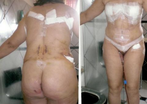  Médico que teria mutilado mulheres em Manaus ganha salvo conduto de 72 horas para se apresentar à Polícia